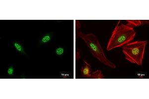 ICC/IF Image XBP1 antibody [N3C3] detects XBP1 protein at nucleus by immunofluorescent analysis. (XBP1 Antikörper)