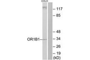 Western blot analysis of extracts from COLO cells, using OR1B1 Antibody. (OR1B1 Antikörper  (AA 161-210))