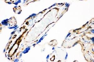 IHC-P: Caveolin-1 antibody testing of human placenta tissue