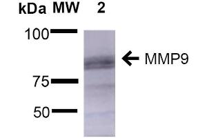 Western Blot analysis of Rat Brain showing detection of ~92 kDa and ~82 kDa (pro and active) MMP9 protein using Mouse Anti-MMP9 Monoclonal Antibody, Clone S51-82 . (MMP 9 Antikörper  (AA 1-708) (Atto 488))
