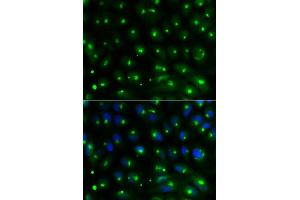 Immunofluorescence analysis of MCF-7 cell using GGA2 antibody. (GGA2 Antikörper  (AA 1-300))