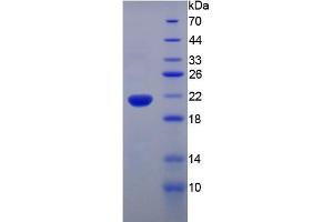 Image no. 1 for Tumor Necrosis Factor alpha (TNF alpha) (AA 80-235) (Active) protein (His tag) (ABIN6239728)