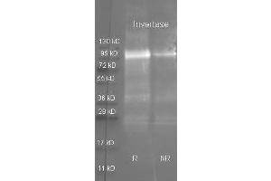Goat anti Invertase antibody  was used to detect purified invertase under reducing (R) and non-reducing (NR) conditions. (Invertase Antikörper)