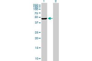 Western Blotting (WB) image for anti-Phosphatidylinositol-5-Phosphate 4-Kinase, Type II, gamma (PIP4K2C) (AA 1-421) antibody (ABIN529081)