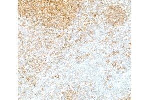 Immunohistochemistry (IHC) image for anti-REL proto-oncogene (c-Rel) (C-Term) antibody (ABIN7795772) (Rekombinanter c-Rel Antikörper  (C-Term))