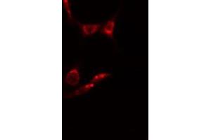 ABIN6278589 staining  HepG2 cells by IF/ICC. (MAK Antikörper  (Internal Region))