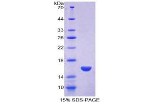 SDS-PAGE (SDS) image for Myeloperoxidase (MPO) (AA 165-278) protein (His tag) (ABIN1080344)