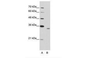 Image no. 2 for anti-RNA Binding Motif Protein 4B (RBM4B) (AA 290-339) antibody (ABIN202338) (RBM4B Antikörper  (AA 290-339))