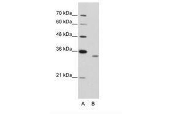 RBM4B Antikörper  (AA 290-339)