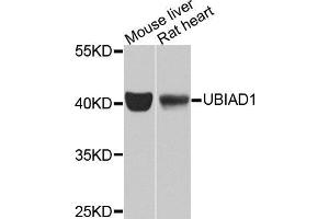 Western blot analysis of extracts of various cell lines, using UBIAD1 antibody (ABIN5975826) at 1/1000 dilution. (UBIAD1 Antikörper)