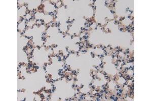 Used in DAB staining on fromalin fixed paraffin- embedded lung tissue