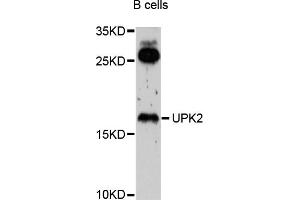 Western blot analysis of extracts of B-cell cells, using UPK2 antibody (ABIN4905559) at 1:1000 dilution. (Uroplakin 2 Antikörper)