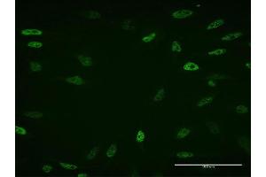 Immunofluorescence of monoclonal antibody to ZBTB33 on HeLa cell. (ZBTB33 Antikörper  (AA 564-673))