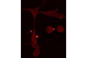 ABIN6275073 staining  Hela cells by IF/ICC.