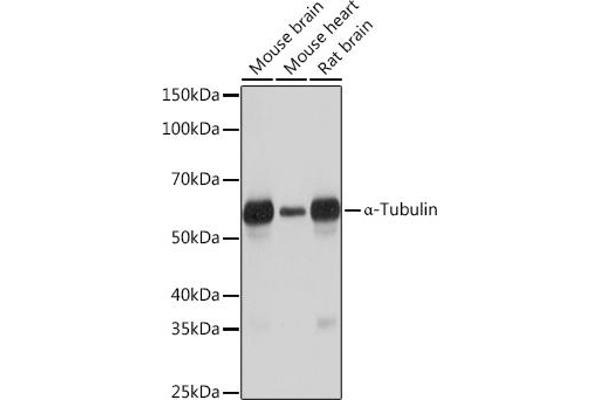 TUBA4A Antikörper