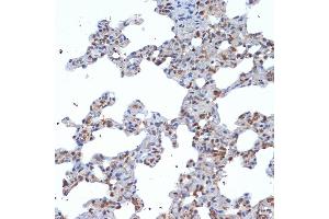 Immunohistochemistry (IHC) image for anti-Suppressor of Cytokine Signaling 2 (SOCS2) antibody (ABIN7270641)