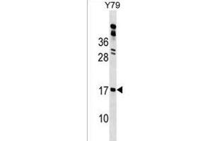 GR1 Antibody (N-term) 18154a western blot analysis in Y79 cell line lysates (35 μg/lane). (GLIPR2 Antikörper  (N-Term))