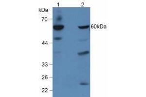 Western blot analysis of (1) Human Hepg2 Cells and (2) Mouse Liver Tissue. (GBA Antikörper  (AA 334-498))
