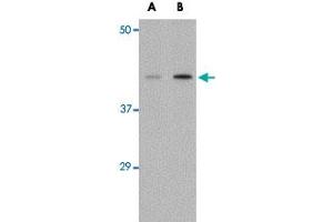 Western blot analysis of AGTR1 in mouse kidney tissue lysate with AGTR1 polyclonal antibody  at (A) 1 and (B) 2 ug/mL . (Angiotensin II Type-1 Receptor Antikörper  (Internal Region))