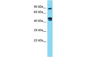Host: Rabbit Target Name: RSPH4A Sample Type: 721_B Whole Cell lysates Antibody Dilution: 1. (RSPH4A Antikörper  (N-Term))