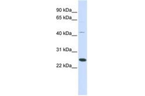 FAM119A Antikörper  (AA 72-121)