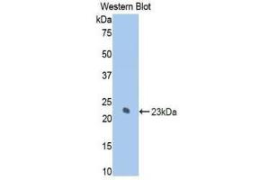 Western Blotting (WB) image for anti-Keratin 7 (KRT7) (AA 255-393) antibody (ABIN1859582) (Cytokeratin 7 Antikörper  (AA 255-393))