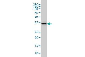 BVES monoclonal antibody (M02), clone 3F7 Western Blot analysis of BVES expression in IMR-32 . (BVES Antikörper  (AA 262-360))