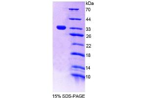 SDS-PAGE (SDS) image for Tyrosine-Protein Phosphatase Non-Receptor Type 22 (PTPN22) (AA 1-256) protein (His tag) (ABIN6239274) (PTPN22 Protein (AA 1-256) (His tag))