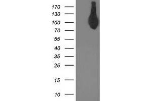 Western Blotting (WB) image for anti-Activating Signal Cointegrator 1 Complex Subunit 2 (ASCC2) antibody (ABIN1496740)