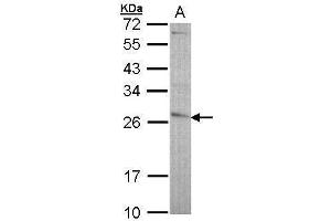 WB Image Sample (30 ug of whole cell lysate) A: A431 , 12% SDS PAGE antibody diluted at 1:5000 (GSTP1 Antikörper  (N-Term))