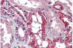 anti-Alkylglycerone Phosphate Synthase (AGPS) antibody