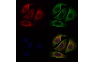 ABIN6266220 and ABIN6277377 staining Hela cells by IF/ICC.