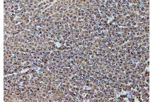 IHC analysis of ADH1A using anti-ADH1A antibody (ABIN4886427).
