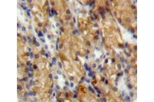 IHC-P analysis of kidney tissue, with DAB staining. (SLIT3 Antikörper  (AA 454-498))