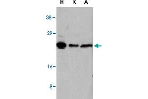 Western blot analysis of NOL3 in HeLa (H), KB (K), and A-549 (A) whole cell lysates with NOL3 polyclonal antibody  at 1 : 1000 dilution. (NOL3 Antikörper  (AA 191-208))