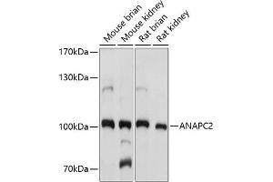 Western blot analysis of extracts of various cell lines, using  antibody (ABIN7265581) at 1:1000 dilution. (ANAPC2 Antikörper  (AA 400-500))