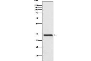 Western blot analysis of HSPB8/HSP22 expression in Human fetal heart lysate.