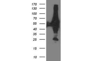 Western Blotting (WB) image for anti-X-Prolyl Aminopeptidase (Aminopeptidase P) 3, Putative (XPNPEP3) antibody (ABIN1501766) (XPNPEP3 Antikörper)