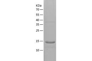 UROD Protein (AA 21-141) (His tag)