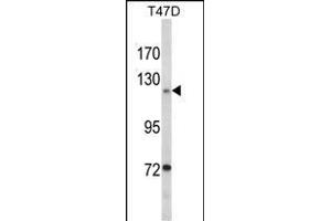 Western blot analysis of PTK2 Antibody (Center) (ABIN1882121 and ABIN2842373) in T47D cell line lysates (35 μg/lane). (FAK Antikörper  (AA 396-423))