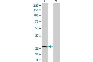 Western Blot analysis of PSPH expression in transfected 293T cell line by PSPH monoclonal antibody (M01A), clone 3A5. (PSPH Antikörper  (AA 1-225))