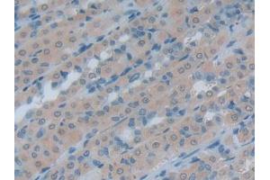 IHC-P analysis of Rat Intestine Tissue, with DAB staining. (HSPH1 Antikörper  (AA 595-733))
