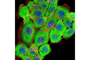 Immunofluorescence (IF) image for anti-Ribosomal Protein S6 Kinase, 90kDa, Polypeptide 2 (RPS6KA2) (AA 415-734) antibody (ABIN5542368)