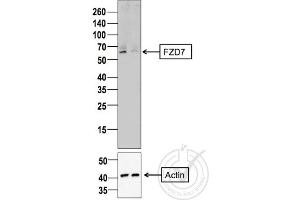 Image provided by the Independent Validation Program (badge number 29805). (FZD7 Antikörper  (AA 501-574))