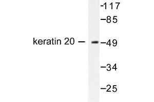 Image no. 1 for anti-Keratin 20 (KRT20) antibody (ABIN265500) (KRT20 Antikörper)