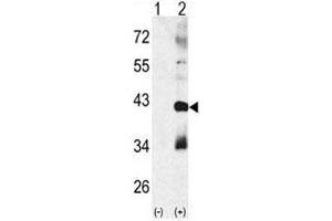 Western blot analysis of MAPK11 antibody and 293 cell lysate (2 ug/lane) either nontransfected (Lane 1) or transiently transfected with the MAPK11 gene (2). (MAPK11 Antikörper  (AA 133-161))