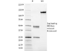 SDS-PAGE Analysis Purified CD41a Mouse Monoclonal Antibody (ITGA2B/1036). (Integrin Alpha2b Antikörper)