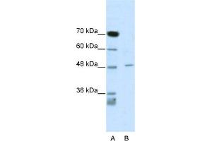 WB Suggested Anti-CACNB4 Antibody Titration:  0. (CACNB4 Antikörper  (C-Term))