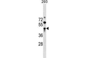 ZBTB32 Antibody (N-term) western blot analysis in 293 cell line lysates (35 µg/lane). (ZBTB32 Antikörper  (N-Term))