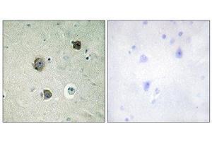 Immunohistochemistry (IHC) image for anti-Cyclin-Dependent Kinase 5 (CDK5) (Tyr15) antibody (ABIN1848070) (CDK5 Antikörper  (Tyr15))